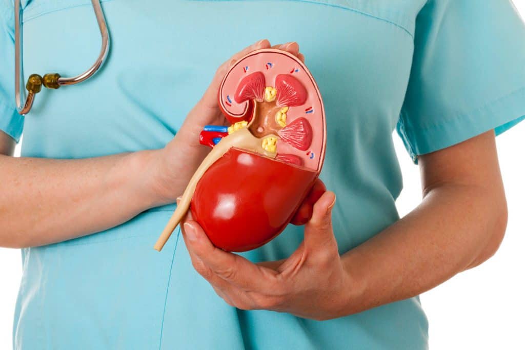 doctor holding model of a kidney to illustrate renal artery stenosis