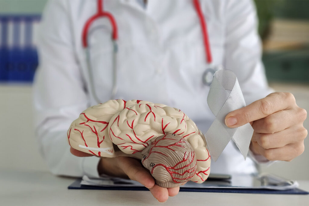 doctor holding a brain in his hand.