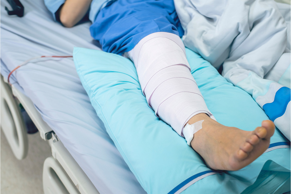leg operation
