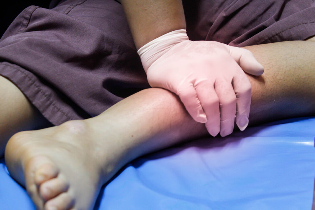 pressing painful spot on leg