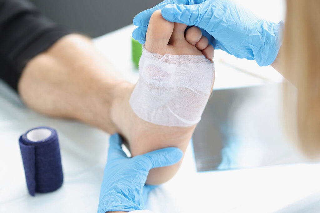 Foot wound wrapped in gauze