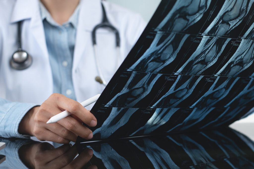 Doctor reviews knee x-rays