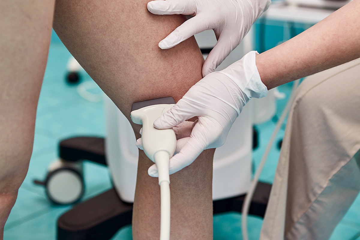ultrasound therapy on leg veins