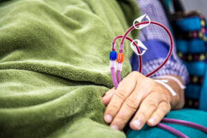 Fistula treatment