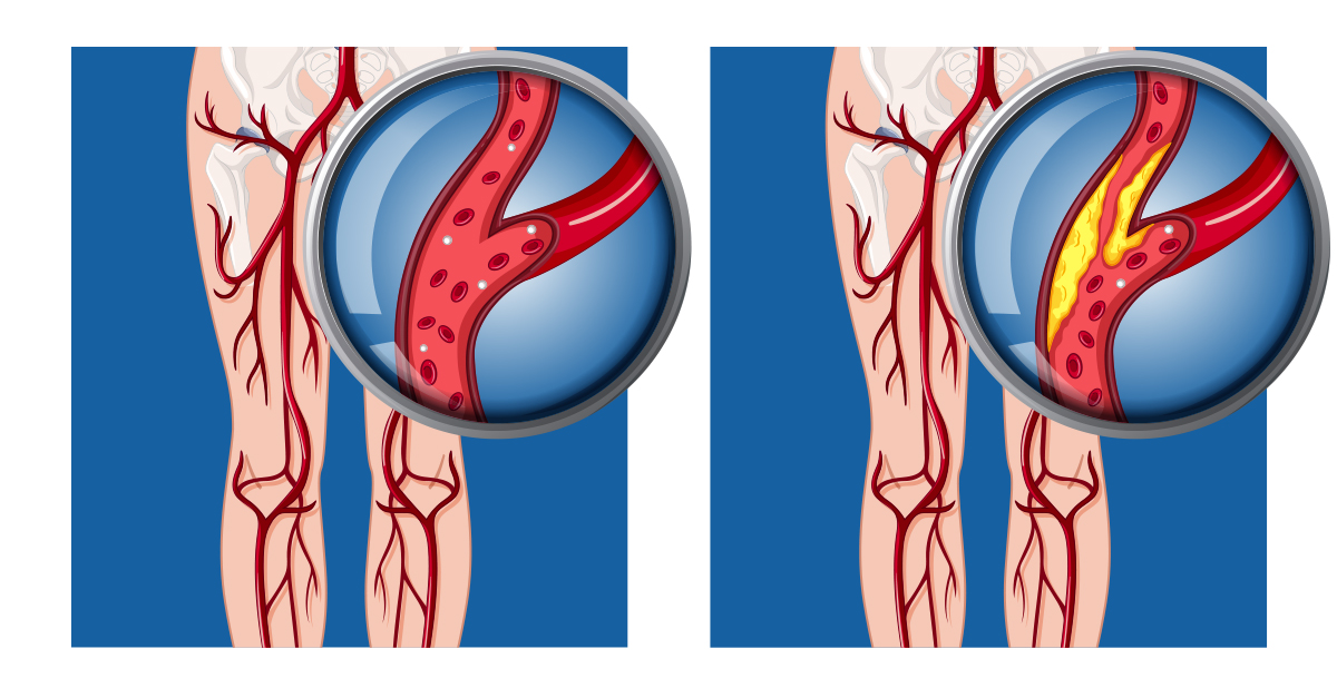 Knee vein diagram