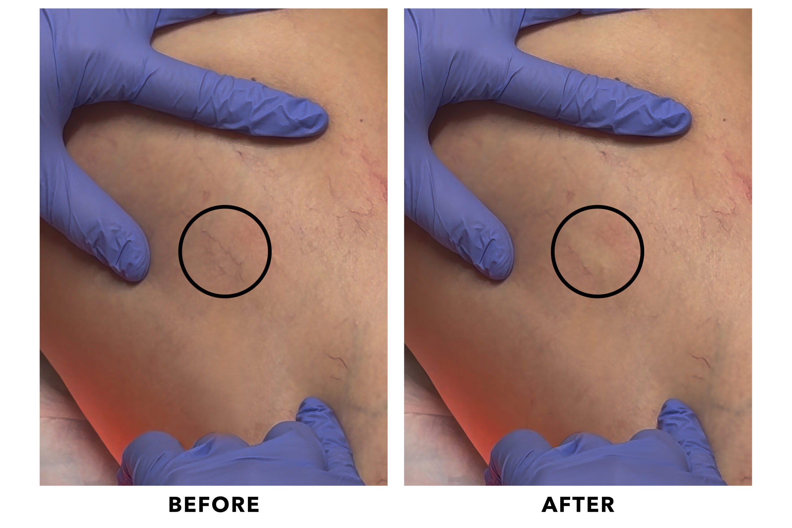 Before and after treatment
