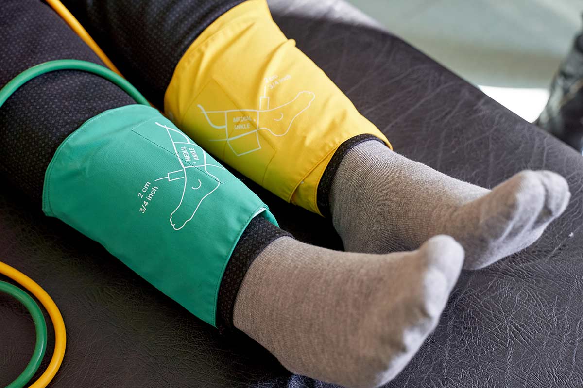 Legs being treated with ankle wraps